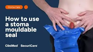 Как использовать формованный уплотнитель для стомы