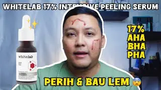 REVIEW + CARA PAKAI WHITELAB 17% INTENSIVE PEELING SERUM