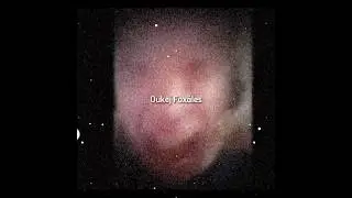 Oukej Fox&aacute;les ​@ Kupta