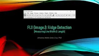 FIJI (ImageJ): Ridge Detection [Measuring Line Width & Length]