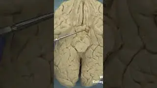 Uncus of parahippocampal gyrus #neuroanatomy #limbicsystem #cortex #forebrain#medicaleducation