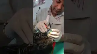 Triphasic hair Mesotherapy Treatment #shorts Dr Goel Plaesthetica