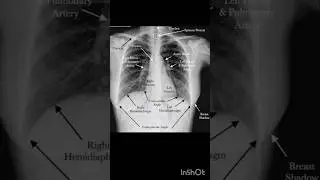 Chest Anatomy #anatomy #trending#youtube shorts #science#viral#doctor#ytshorts #youtube #Radiography