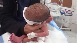 ❤️Very Hungry NNJ Baby Enjoying Bottle Feeding😍