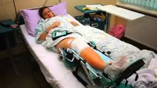 What Injuries Can I Claim In A Bicycle Accident Claim Or Lawsuit?