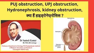 PUJ obstruction. UPJ obstruction क्या हैं | Hydronephrosis के कारण | Dr.(Prof)Santosh Kumar PGI