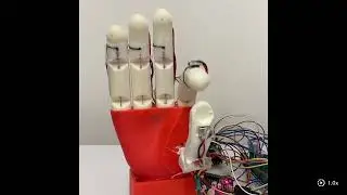 3D Printed Soft Robotic Prosthetic Hand Direct Transition Between Various Gestures