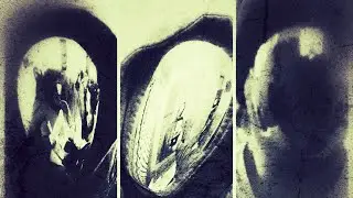 Spinal Severance Package - 010100000110010101101110011010010111001101100010011101010111010001110100