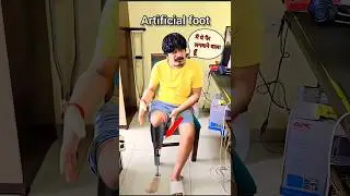 gyan gaming accident 👺 ||artificial foot for leg prosthesis