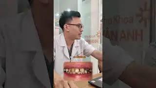 Nguy&ecirc;n Nh&acirc;n M&ograve;n Cổ Răng G&acirc;y &Ecirc; Buốt 90% C&ocirc; Ch&uacute; Lớn Tuổi Mắc Phải