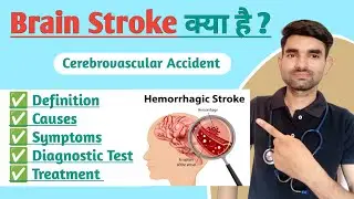 Cerebrovascular Accident in Hindi | Causes, Symptoms And Treatment of Brain Stroke in Hindi