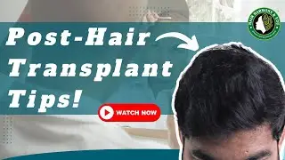 Post Hair Transplant Tips | Long-Term Results & Maintenance Tips Explained !