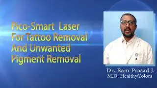 tattoo removal in hyderabad | permanent tattoo removal in hyderabad |  tattoo removal