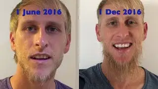 Can a blonde guy grow a beard?