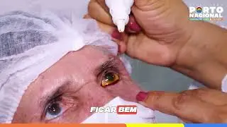 Mutir&atilde;o de cirurgias de catarata, pter&iacute;gio e limpeza de lentes