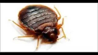Bed Bug Treatment Preparation Tutorial/How to Get Rid of Bed Bugs