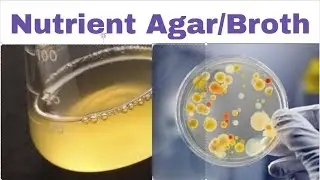 Nutrient Agar |Composition and Uses