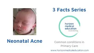 Neonatal Acne  explained| newborn rashes #3facts