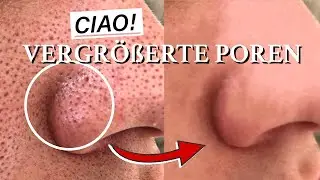 Kein Witz!👃❌ Vergr&ouml;&szlig;erte Poren im Gesicht loswerden (Gro&szlig;e auf Nase, Wangen, Stirn entfernen)