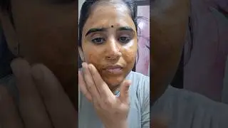 മുഖത്തെ TAN മാറ്റാൻ Coffee + Curd 😍 ||Easy Home Remedy||Sun Tan gone! ☀️ Coffee & Curd Face Pack