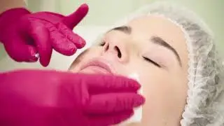 Neauvia коррекция губ препаратом Intense Lips. Работа тренера Neauvia Корчагиной Елены.