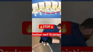 Tu as mal au nerf sciatique ? Fais &ccedil;a tous les jours ! 3 fois 20 SEC