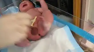 Baby's First Breath- VERY Rough Nurse