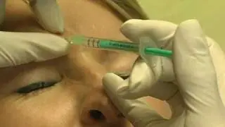Botox Injectables