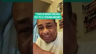 THIS IS WHAT DRUGS DO TO A YOUNG BRAIN #brainreaction #yourbrain #brainpills #brainweek