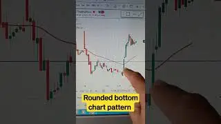 Rounded bottom chart pattern #shorts #shortvideo #nifty50 #tuntuntrading