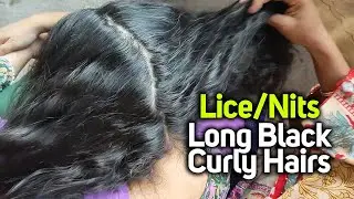 Long Black Curly Hairs Picking Lices Nits Head Scratch | ASMR Pakistan