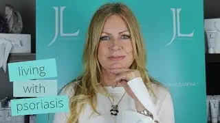 PSORIASIS TREATMENT + DIET | treating psoriasis naturally