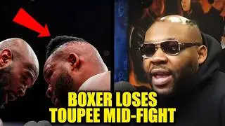 Boxer Wins Fight After Getting Toupee Punched Off, Speaks Out