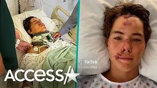 TikTok Star Caleb Coffee Survives  60-Foot Fall Off Of Cliff In Hawaii