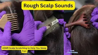 ASMR Scalp Scratching to Help You Sleep Fast #15