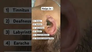 Ear Treatment - KARNAPOORAN | Tinitus | Deafness
