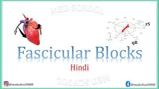 Fascicular Blocks Hindi