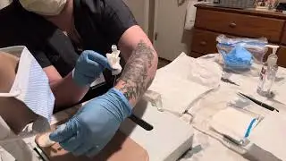 Picc line dressing change remediation