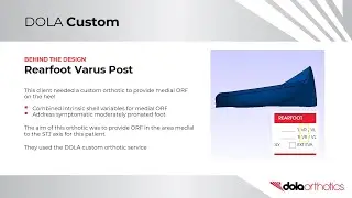 Rearfoot Varus Post DOLA Orthotics Orthotips