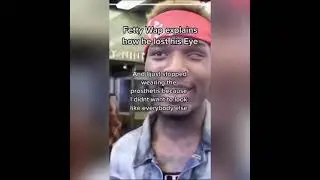 Fetty wap explaining how he lost his eye