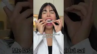 Prob&eacute; pr&oacute;tesis de carillas: spoiler Mali&oacute; sal 🥹 #shorts
