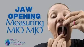 Jaw Opening—Measuring MIO MJO