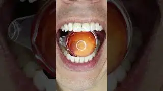 ASMR | Mars Planet Gum Ball