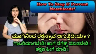 ಮೂಗಿನಿಂದ ರಕ್ತಸ್ರಾವ ಆಗುತ್ತಿದೀಯಾ? ತಕ್ಷಣ ಹೀಗೆ ಮಾಡಿ #nosebleed #epistasis #bleeding #bodyheat