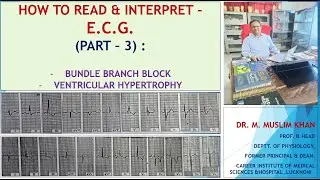 HOW TO READ &INTERPRET E.C.G.(PART-3):#BUNDLE BRANCH BLOCK&VENTRICULAR HYPERTROPHY#BY DR.MUSLIM KHAN