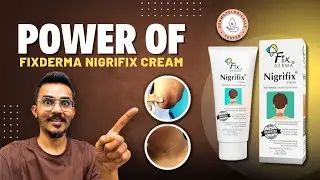 Top Dermatologist Reveals BEST Cream for Dark Neck & Underarms | Fixderma Nigrifix Cream