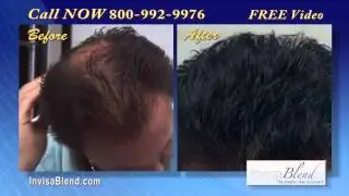Hair Replacement for Hair Loss gives REBATES - InvisaBlend Review