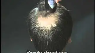 Super Million Hair Fibres