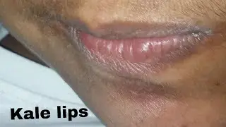 @chadtag pigmentation lips kala hout how to fix this problem solution in this video 