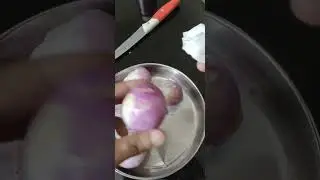 Onion Storage in refrigerator # Storage tips # kitchen useful tips